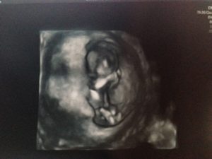 d00c0313ff656870a80cb5df4d573767_s